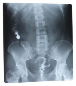 565fd10e7a0e366539bea9148c0b4587